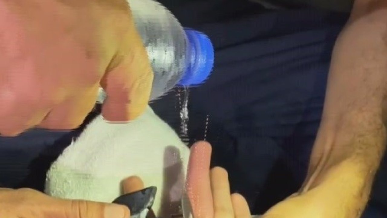 Parmağına yüzük sıkışan vatandaşın imdadına itfaiye ekipleri yetişti