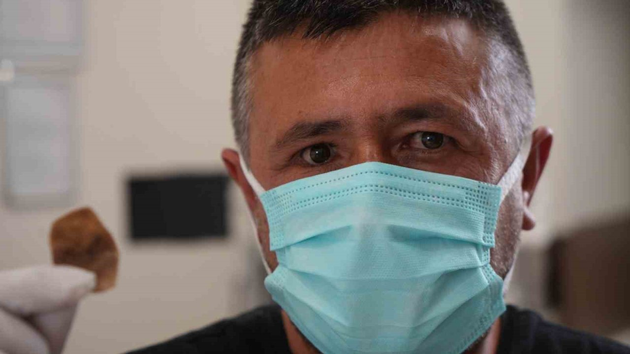 Protez gözü hayatını kabusa çevirdi